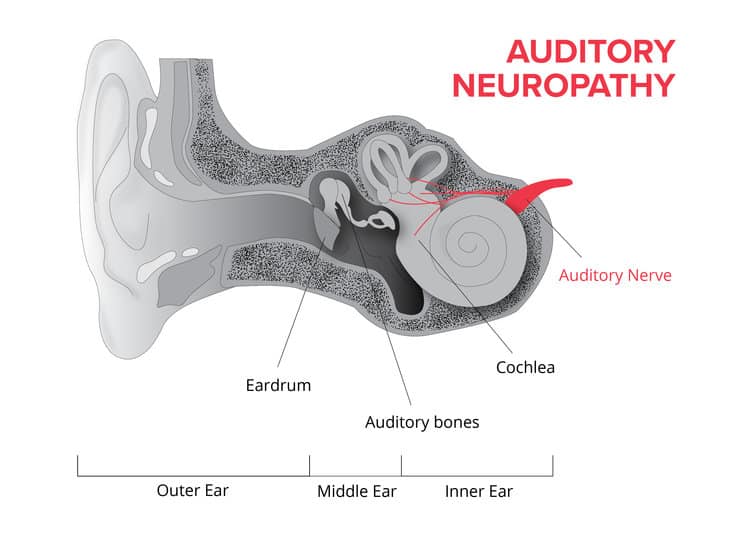 adhd central auditory processing disorder